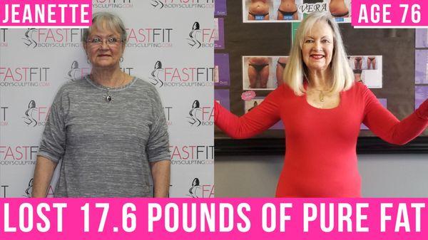 Fast Fit Body Sculpting Fat Weight Loss Review Before and After Skin Tightening