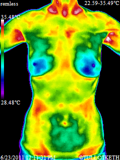 Clinical thermography is a physiological test, unlike ultrasound or MRI's which are structural. All offer important info.