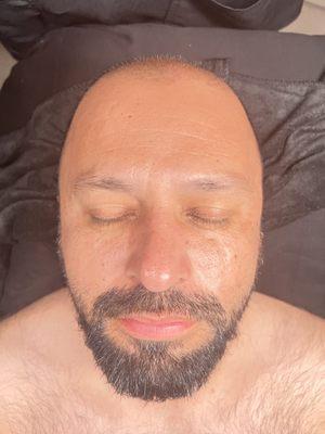 after bliss facial