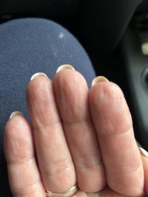 Length of nails on right hand are longer than the left.