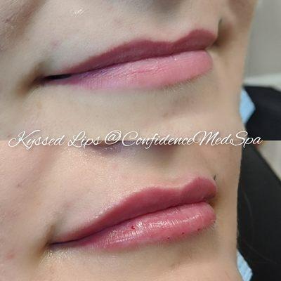 Kysse Lips~ Immediately post 1ml