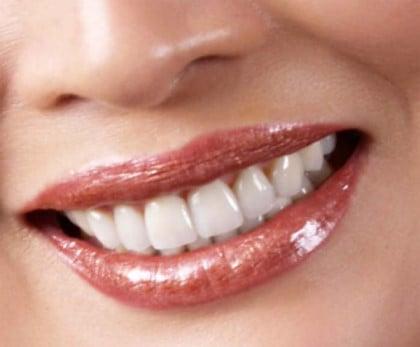 Call us for your free smile consultation right now. Crowns, Bridges, Veneers, Laminates,  Pain free- Lumineers, Zoom whitening.