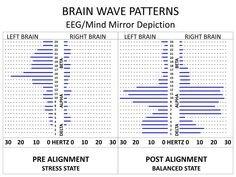 Post Alignment, the brain measures high Alpha brainwave activity.  The nervous system and brain reboot, tension drops, and power restored.