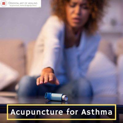 Acupuncture Relieves Asthma Attacks. Researchers find acupuncture effective for relieving allergic asthma