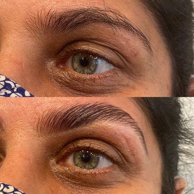 Brow lifting, aka brow lamination