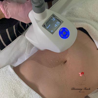 abdomen sculpting treatment, reduction treatment