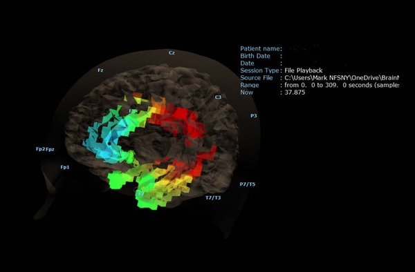 Neurofeedback Services Of New York