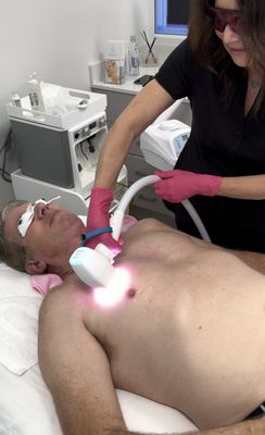 Laser hair removal for men