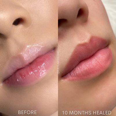 Healed Lip Blush