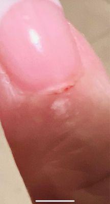 Here's a picture,  skin cut under the cuticle by a clipper but the cuticle left hanging.  No thanks.