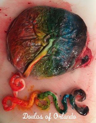 Rainbow baby placenta