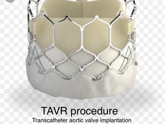 Minimally invasive valve procedure