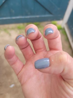 Dip residue around nails.