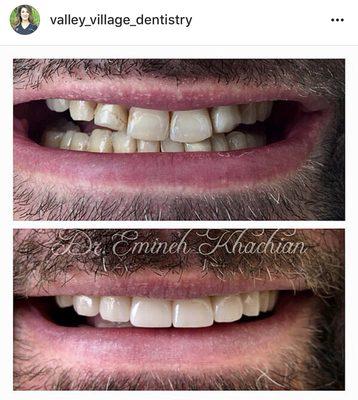 Beautiful smile transformation!