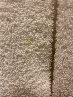 stain on the towel