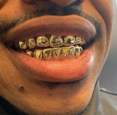 Gold Grillz Grillz by solez 864