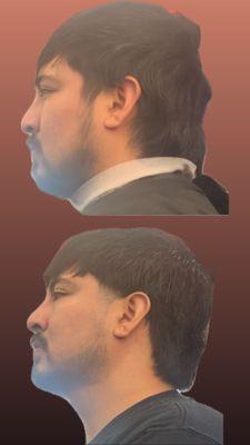 Before and after. Mullet with taper on sides, beard trim, shear work and texture all around, and line up.