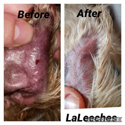 Ear hematoma treatment with leeches.