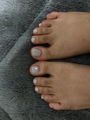 Bad gel pedicure