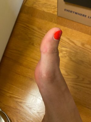 My foot after pedicure