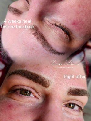 4-6 week retouch