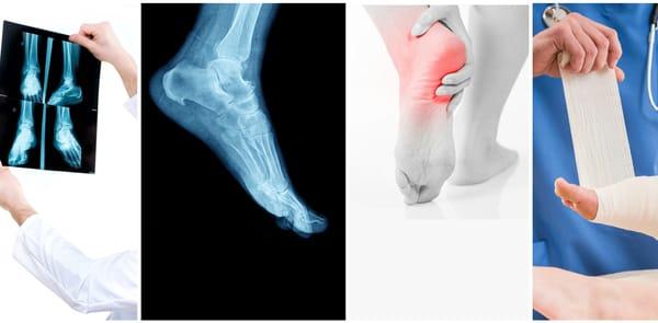 330 West Foot Care provides the most complete care options for foot injuries, bunions, ingrown toenails, and a variety of oth...