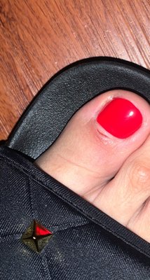 Cut on my toe from the pedicure