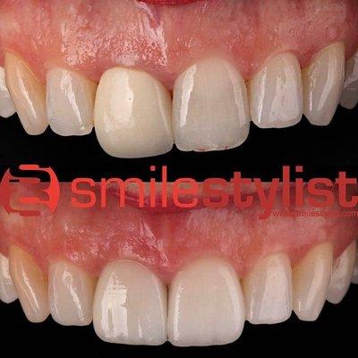 SmileStylist