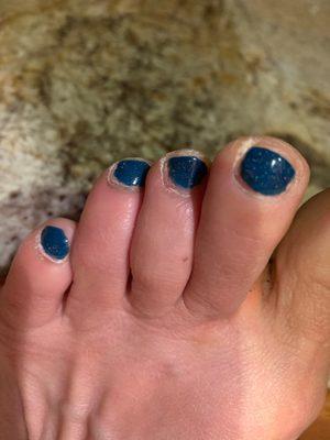 Toe nails