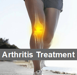 Treatment for All Types of Arthritis