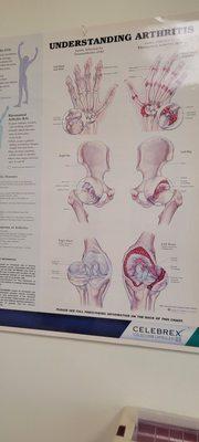 Arthritis information