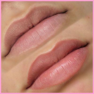 Lip definition enhancement through one Lip Blush service session.