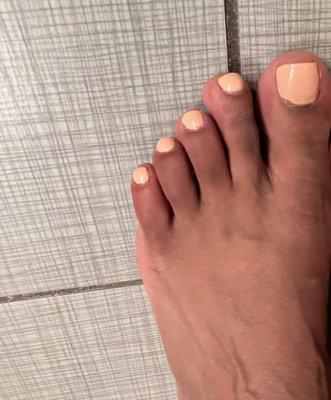 Sloppy pedicure