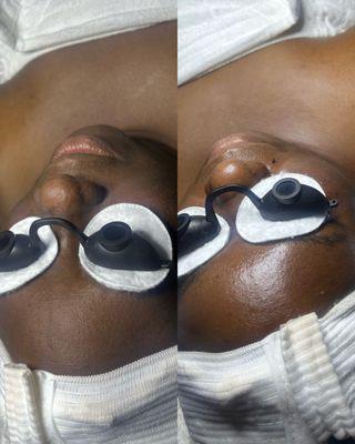 Customized Facial Treatment