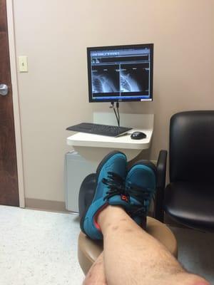 thats my X-ray and my new shoes.