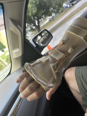 Fancy custom splint