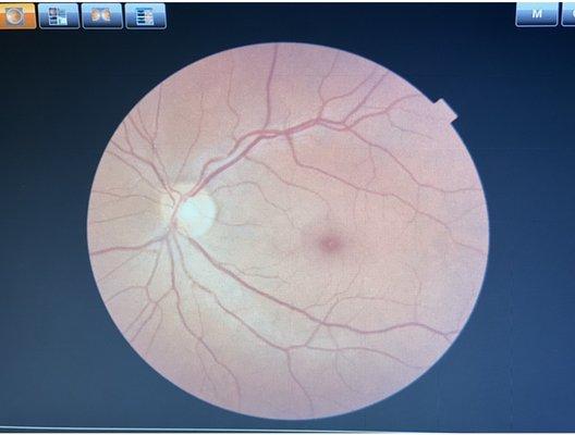 Photo of my retina!