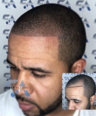 Scalp Pigmentation Bethesda MD