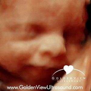 HD Live Image captured at GoldenView Ultrasound at 27 weeks