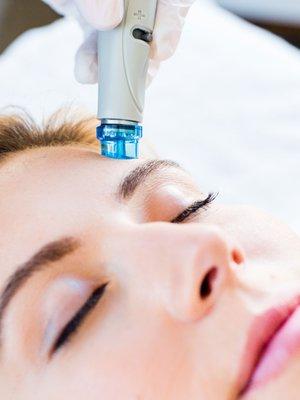 Hydrafacial