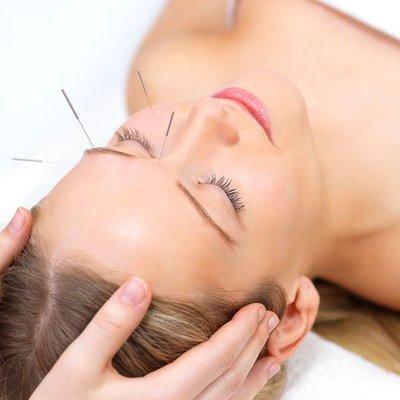 Facial acupuncture