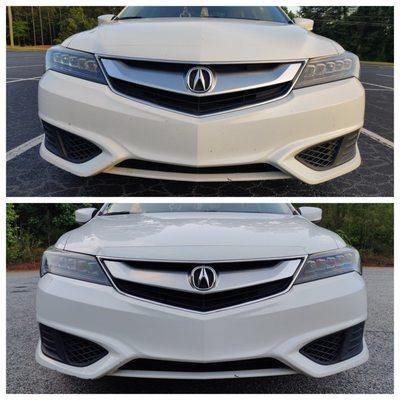 2016 Acura ILX before and after (front end)