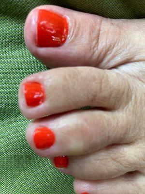 Polish over cuticles and on skin around toe.