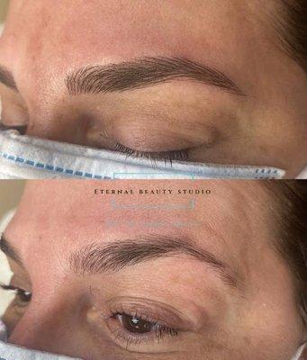 Microblading technique.