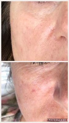 Before (bottom) and after Dermalogica Biolumin - C serum