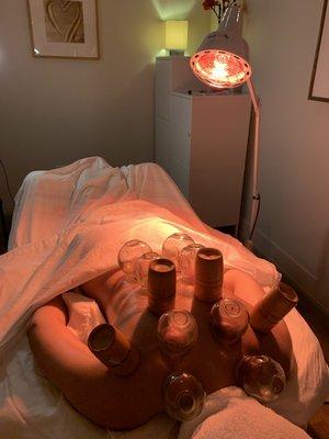 Cupping Therapy with bamboo and glass cups