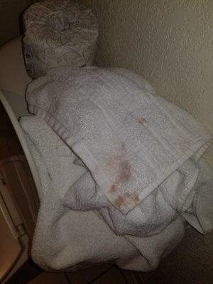 What the hell is this stain on the supposed clean towel??