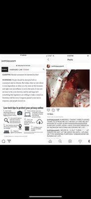 didn't believe me, bleeding to death instead writes 38estacy pills under my name. What caused this was instagram, yelpdoesnthelp