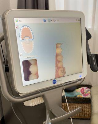 Invisalign consult