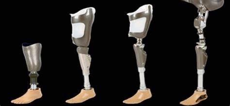 Prosthesis